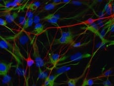 hES_derived_motor_neurons_and_glia