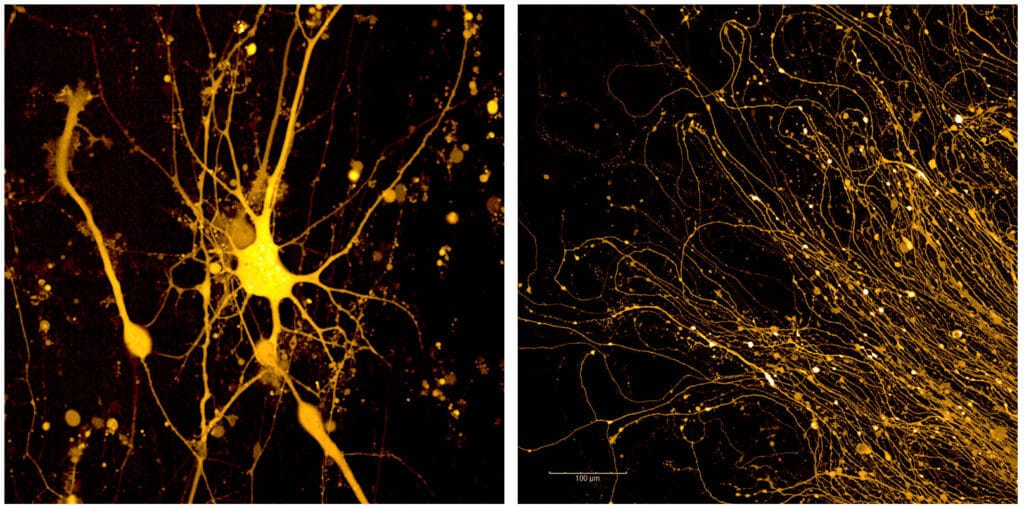 A Clearer Window Into Disease: Meet the Opera Phenix Microscope - New ...